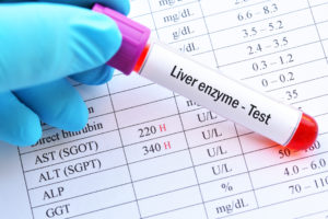 Fatty Liver