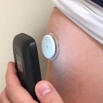 Διαβήτης και διαχείριση στην πρωτοβάθμια φροντίδα υγείας : Συνεχής καταγραφή γλυκόζης CGM (continuous glucose monitoring) ή Holter Σακχάρου